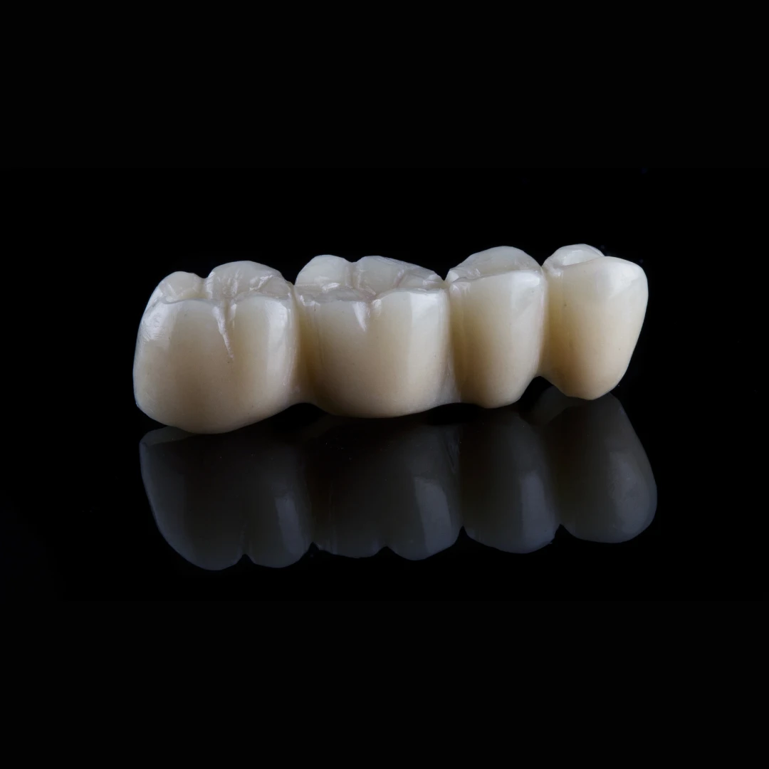 Dental Bridges