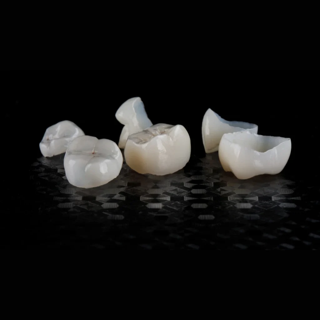 Porcelain Crowns