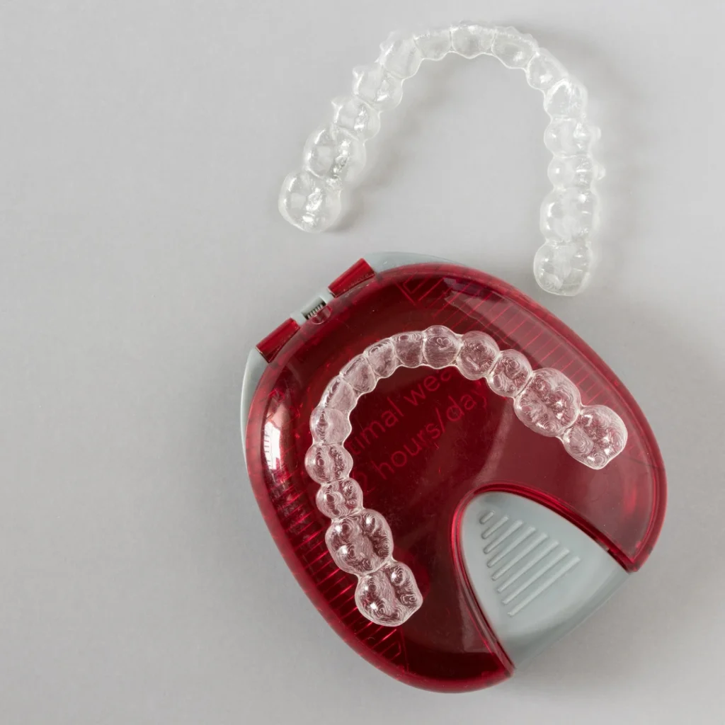 What to Expect During Invisalign Treatment