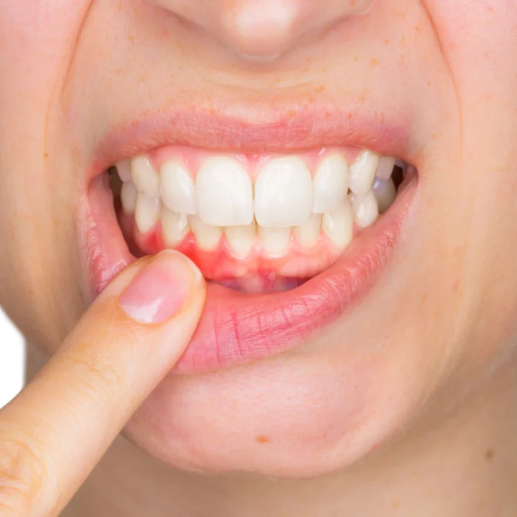 Benefits of Regular Dental Cleanings