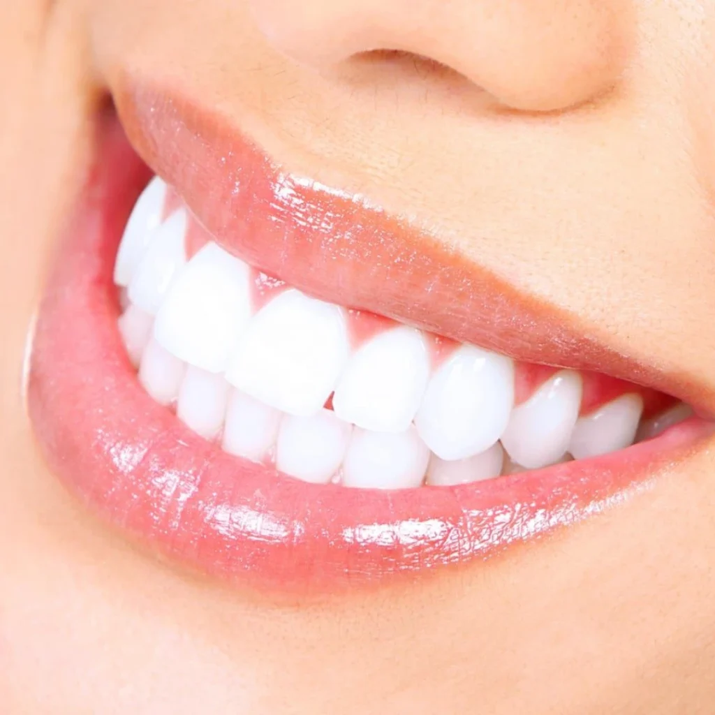 Best Teeth Whitening Treatment in Clarksville, AR