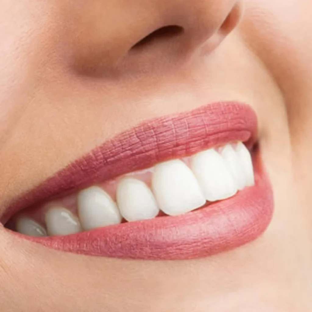 Caring for Your New Smile
