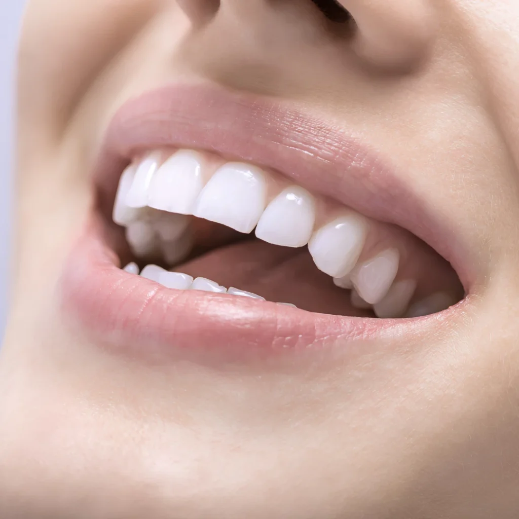 Is Dental Bonding Right for You