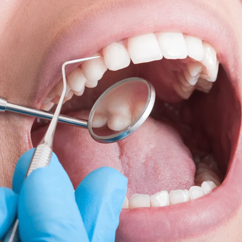 Routine Dental Exams & Cleanings