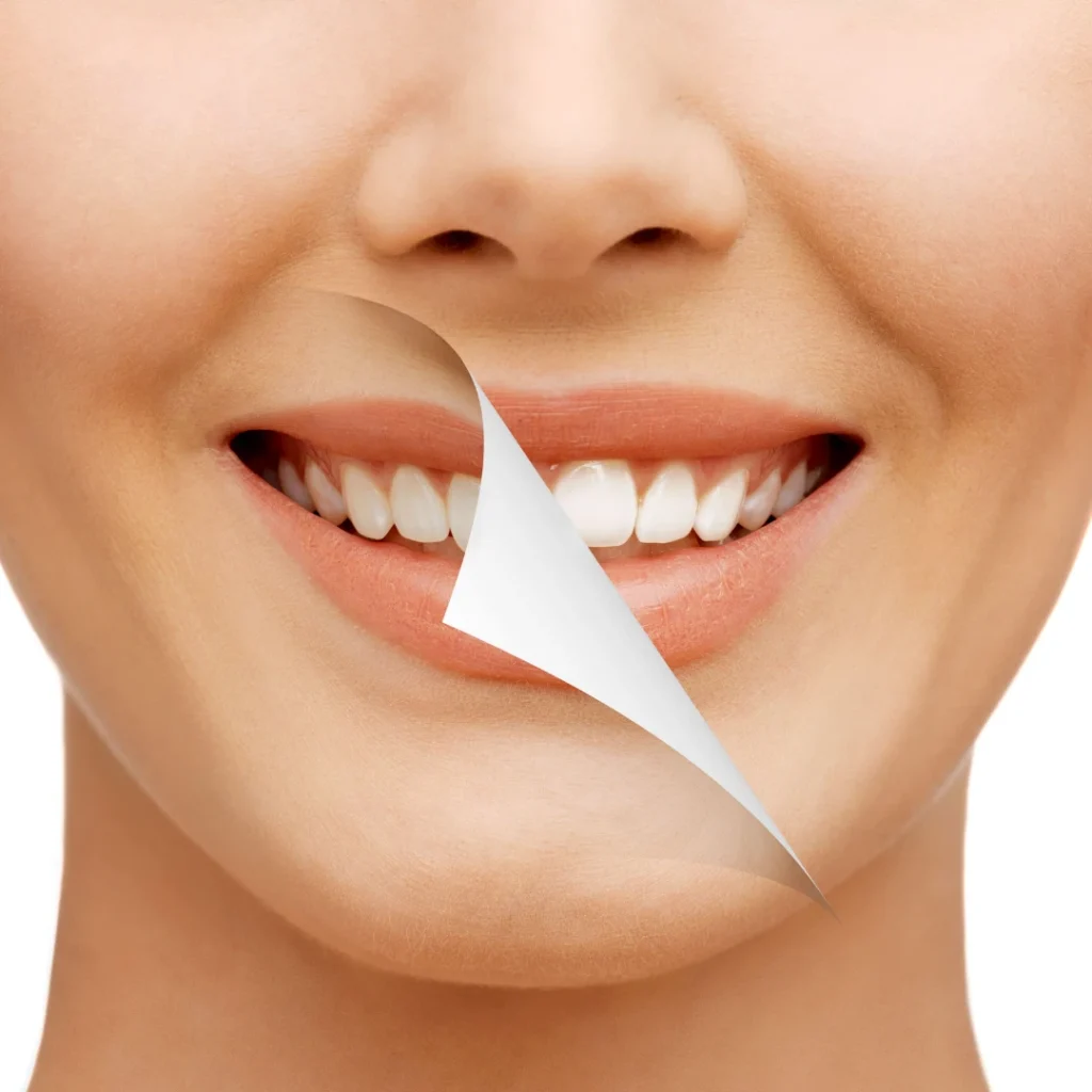 Smile Makeover in Clarksville, AR