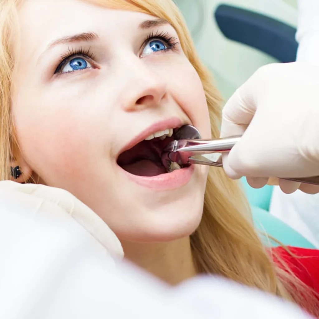 Tooth Extractions in Clarksville, AR