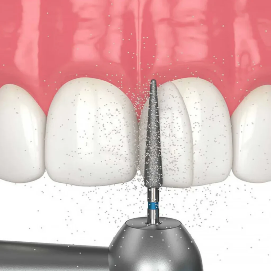 What to Expect During Treatment