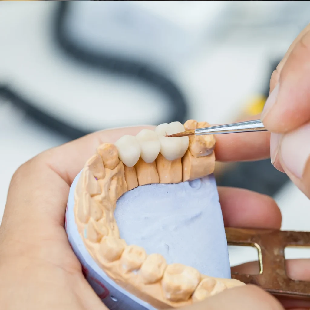 What to Expect During Treatment