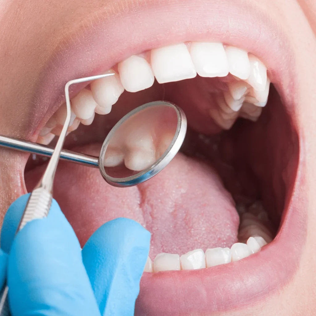 Why Are Dental Exams Important